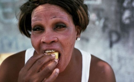 Dépigmentation: le douloureux secret des femmes noires