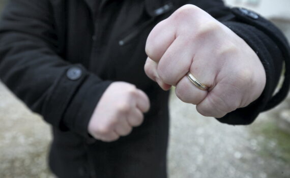 Lors d’une bagarre dans un foyer à Belfort, il arrache le doigt d’un sénégalais