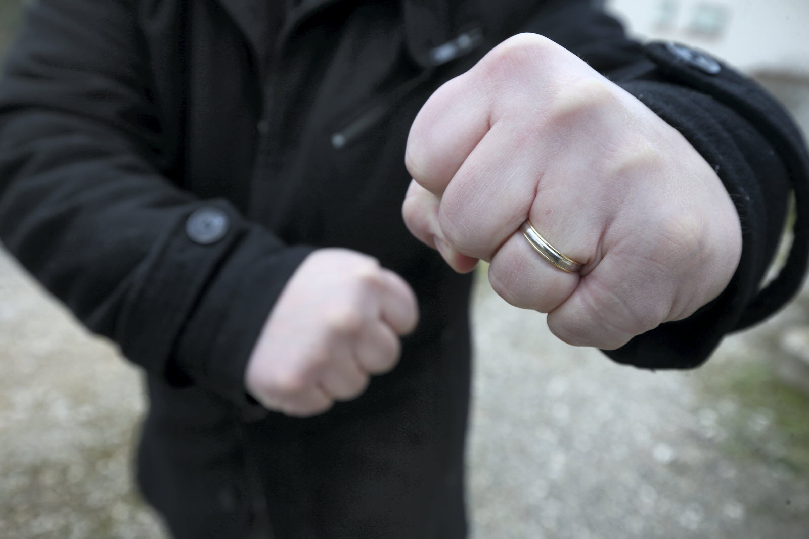 Lors d’une bagarre dans un foyer à Belfort, il arrache le doigt d’un sénégalais